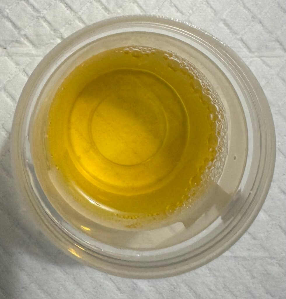 A urine cup filled with fresh urine is the specimen of choice for urinalysis testing.