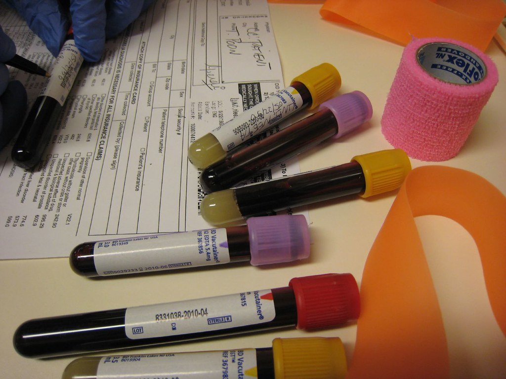 Clinical laboratory image related to Labcorp OnDemand vs Walk