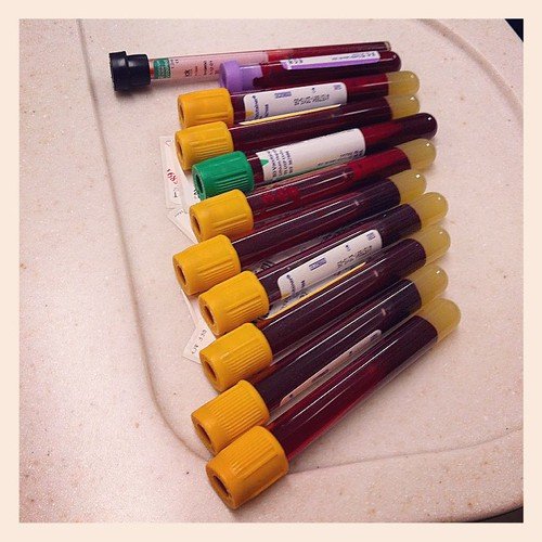 Surprise! Evidently I'm Giving Blood Tonight. #labwork #hersheysyrup #vials #phlebotomy #vampiresnax related to How to Order Your Own Blood Tests