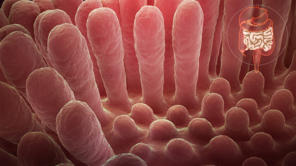Inflammed Mucous Layer Of The Intestinal Villi Depicting Celiac Disease