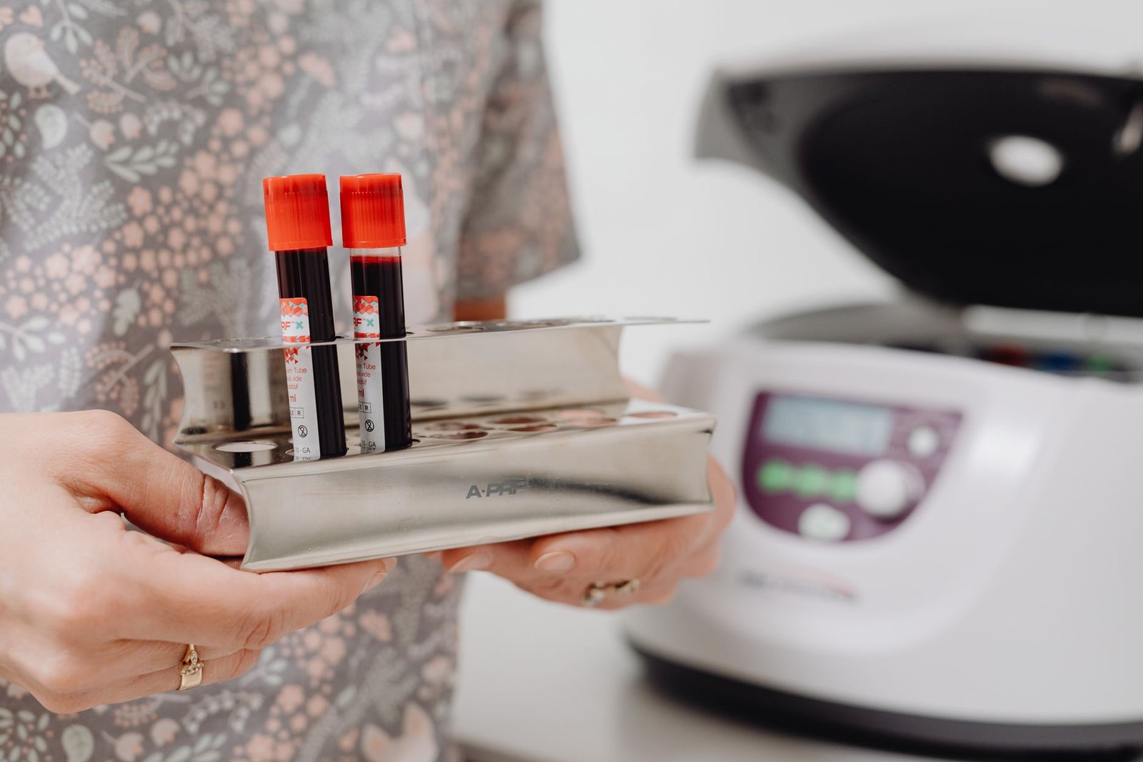 Clinical Laboratory Blood Testing