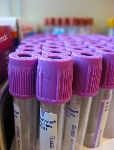 Blood collection tubes prepared for routine clinical laboratory testing