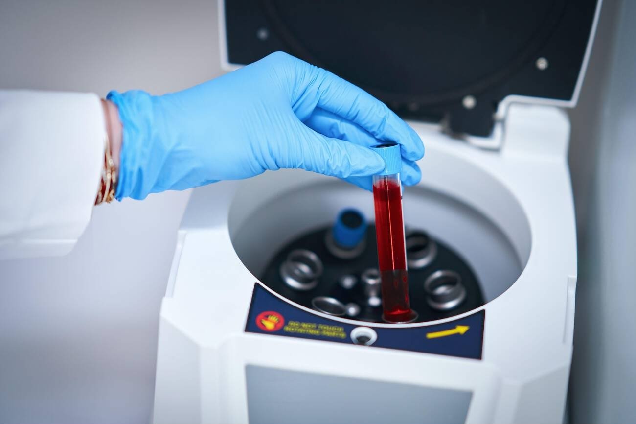 NABL Accredited Pathology Lab And Diagnostic Centre In Kharghar, Navi Mumbai Full Body Checkup, CBC, Thyroid Blood Test And Home Blood Collection