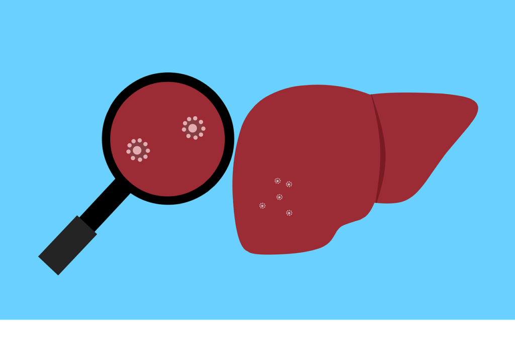 Liver, Bacteria, Virus, Hepatitis, Diseased, Healthcare, Medical, Organ, Hepatic, Infection, Magnifier, Biology, Disease, Science, Human, Health, Unhealthy, Gastrointestinal, Sick, Diseases, Diagnosis, Cancer, Accessory, Emergency, Scientific, Liver, Liver, Liver, Liver, Liver
