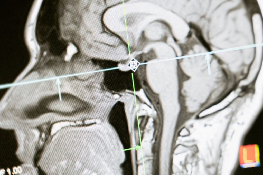 Close Up Of An MRI Scan Showing A Sagittal View Of The Human Brain For Analysis.