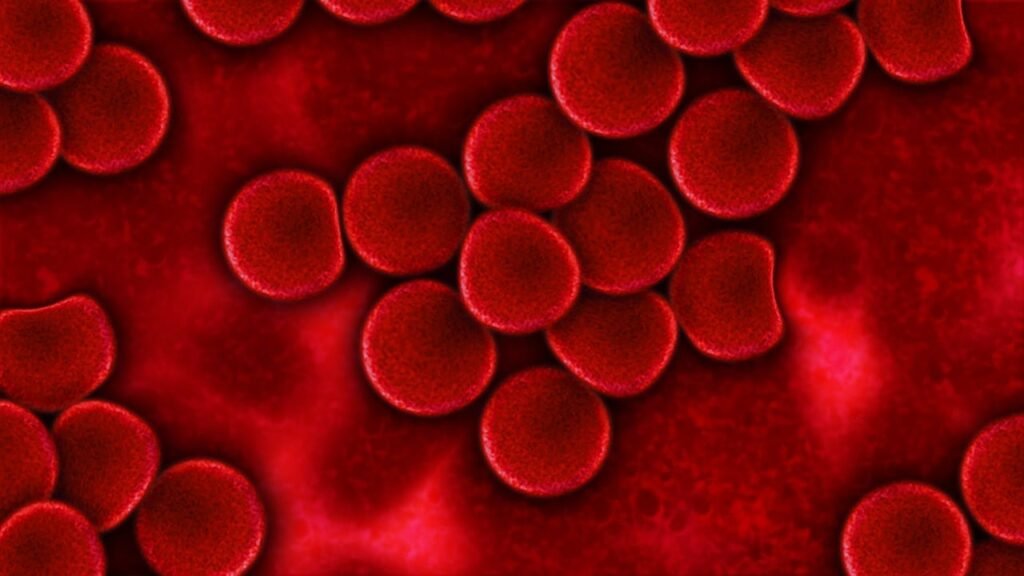 Blood Plasma, Red Blood Cells, Plasma, Infection, Health, Blood Cells, Haemocytes, Red, Magnification