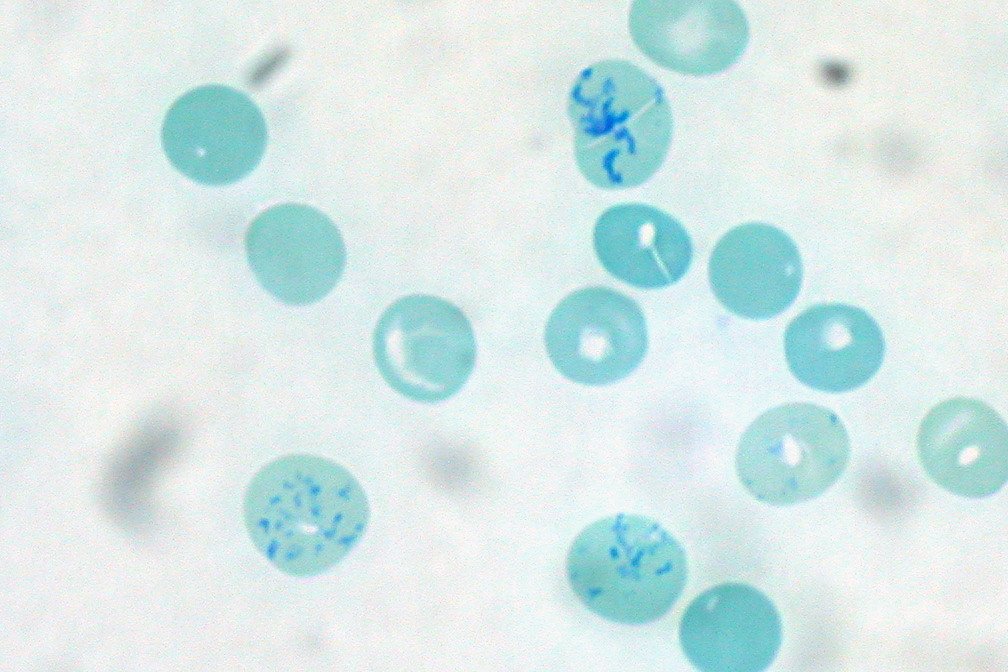 Reticulocytes In Peripheral Blood (supravital Stain)
