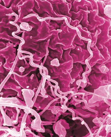 Syphilis Bacteria
